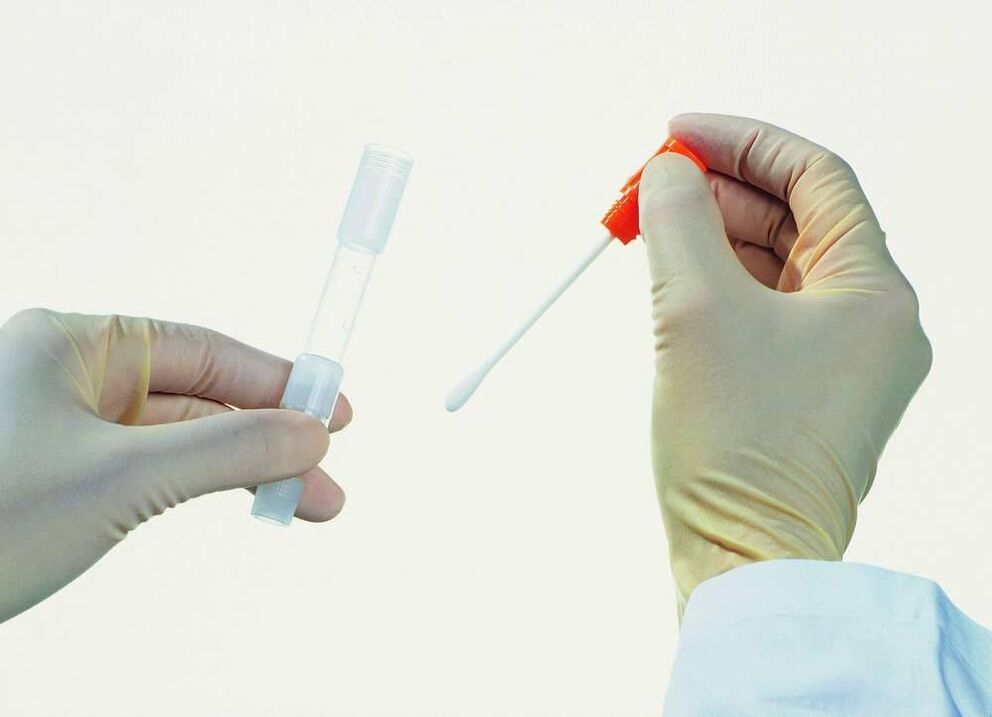 Analysis collection to detect chronic prostatitis