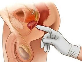 Prostate massage for treating prostatitis in men