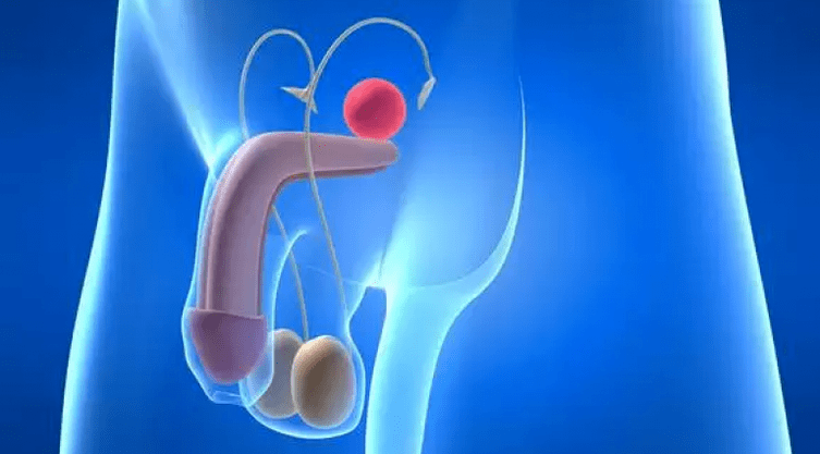 Prostatitis is an inflammation of the prostate gland in men that requires complex treatment